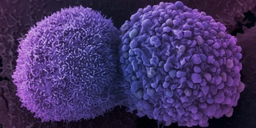 Will We Test for Cervical Cancer at Home?