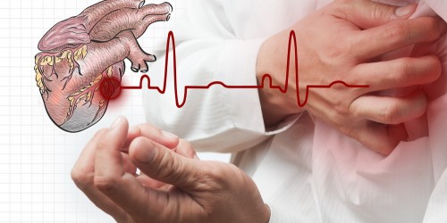 Gradual Heart Attack Pain Means Bigger Treatment Delay