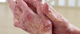 Controlling and Managing Arthritis