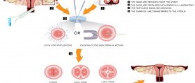 Lost All Hope? Maybe You Can Try In Vitro Fertilization (IVF)