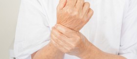 5 Things You Should Know About Osteoporosis And Lupus