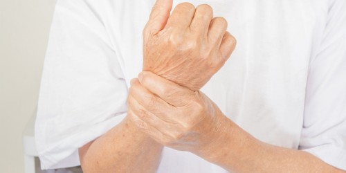 5 Things You Should Know About Osteoporosis And Lupus