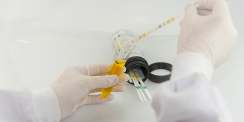 5 Ways To Diagnose A UTI: Tests And Procedures Used To Diagnose Urinary Tract Infections