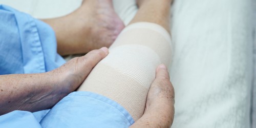 6 Things You Should Know About Unicompartmental (Partial) Knee Replacement