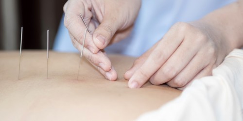 Acupuncture To Help Treat Osteoporosis: What Does The Science Say?
