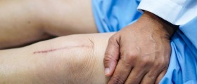 Arthritis Treatment: 4 Things You Should Know About Different Types Of Knee Replacement Surgery