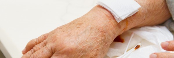 Arthritis and Your Skin: 6 Ways RA Affects Skin Problems