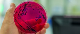 Can You Really End Up With Sepsis Due To A UTI?