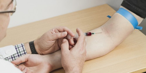 Diagnosing Arthritis With Blood Tests: What Can General And Specialized Blood Tests Reveal?