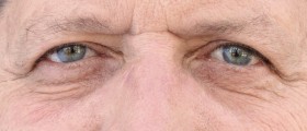 How To Deal With Emotions In Dementia: 5 Common Changes In Emotional Behavior