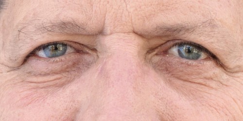 How To Deal With Emotions In Dementia: 5 Common Changes In Emotional Behavior