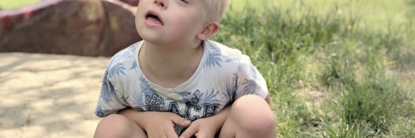 Is There A Connection Between Down Syndrome And Alzheimer's Disease?