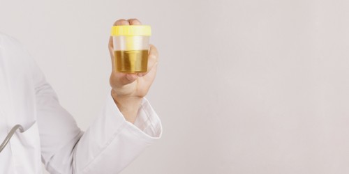 Nongonoccocal Urethritis Overview: Causes, Signs, Symptoms, Diagnosis And Treatment