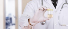 Smelly Or Cloudy Pee: UTI Or Could It Be Something Else?