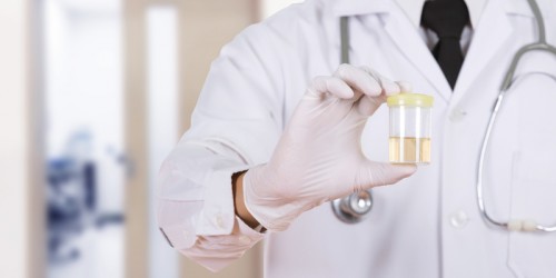 Smelly Or Cloudy Pee: UTI Or Could It Be Something Else?