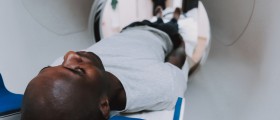 Aortic Occlusive Disease: What Is It, And How It Can Be Treated?