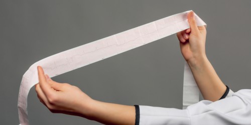 Arrhythmia And Conduction Disorders: What Is Bundle Branch Block?