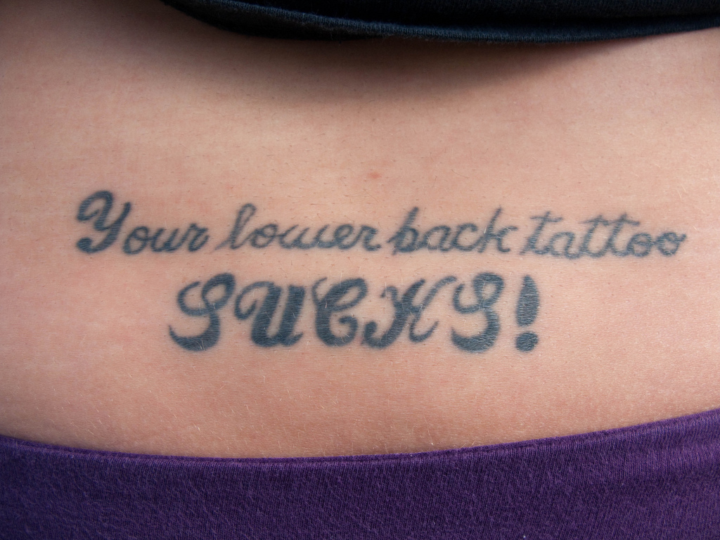tatoo over keloid scar skin growths and pigment disorders tatoo over keloid scar skin growths and pigment disorders