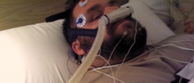 Can Pacemakers Cure Obstructive Sleep Apnea?