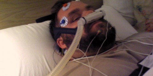 Can Pacemakers Cure Obstructive Sleep Apnea?