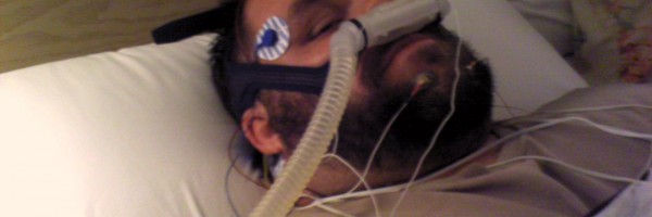 Can Pacemakers Cure Obstructive Sleep Apnea?