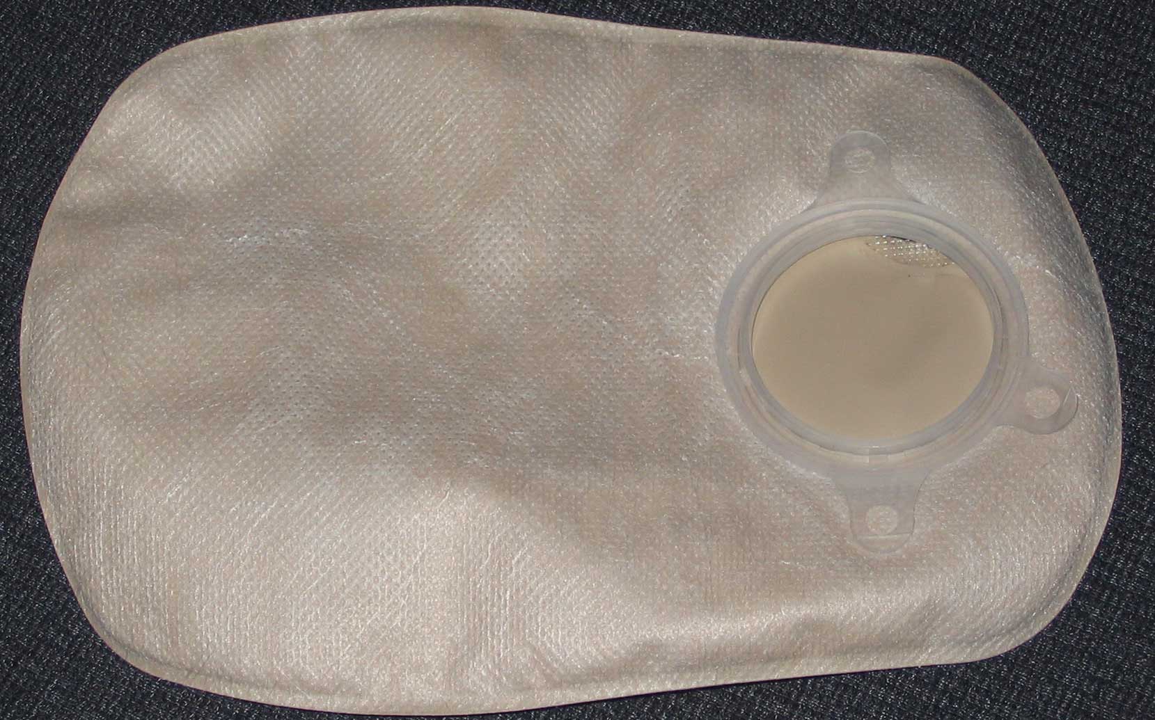 Living With A Colostomy Bag What You Need To Know Gastrointestinal
