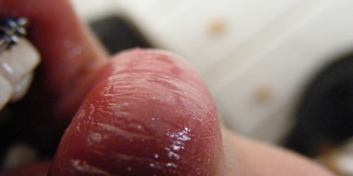 Dental Braces For Adults: What Do You Need To Know?