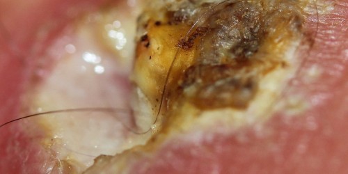 Alert: Are You Using Any Of These Absolutely Useless Alternative Remedies?