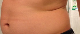 10 Tremendously Unexpected Causes Of Sudden Weight Gain