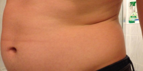 10 Tremendously Unexpected Causes Of Sudden Weight Gain