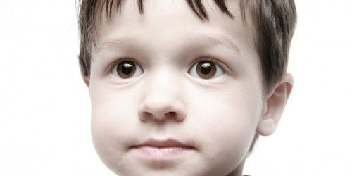 How Family Snapshots Can Save Lives: Eye Cancer In Pictures