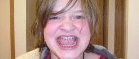 When Orthodontic Is Treatment More Than Just Cosmetic: Braces For Medical Reasons