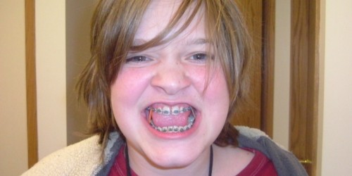 When Orthodontic Is Treatment More Than Just Cosmetic: Braces For Medical Reasons