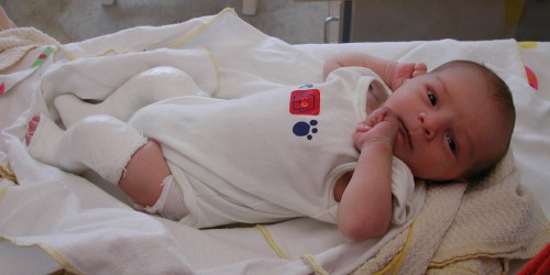 What Is Clubfoot, And How Can This Foot Deformity Be Treated?