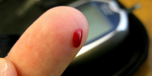 Sulfonylureas For Diabetes, Obsolete But Still Commonly Prescribed