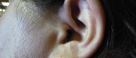 Severe ear pain caused when I lay down at night. | Ear Disorders and