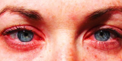 Living With Fall Allergies: Triggers, Coping Strategies, And Medication Options