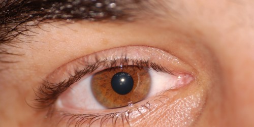 Gene Therapy Combats Hereditary Blindness