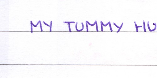 Abdominal Pain: Is It Serious Or Not?