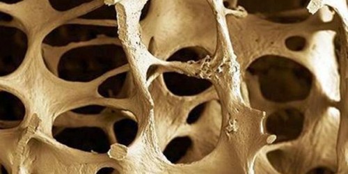 Why Vitamin K2 Is Critical For Good Heart And Bone Health