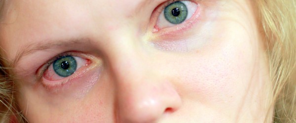 types-of-eye-infections-in-adults-eye-disorders-and-diseases-articles