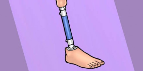 The World's First Artificial Limb (That's Really A Limb)