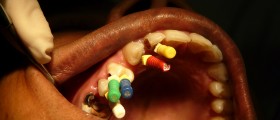 Root Canal Treatment: No Longer The Stuff Of Nightmares