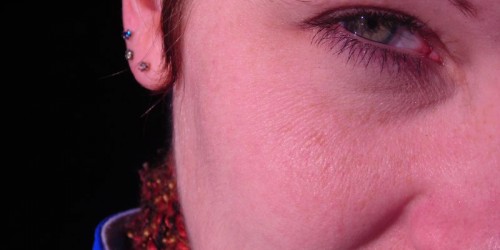 Vitamin D Could Help Heart-Failure Patients, Study Suggests