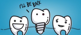 Can New Dental Implants Be Placed In Areas Where Old Implants Have Failed?
