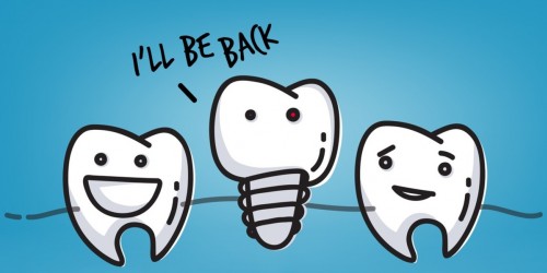 Can New Dental Implants Be Placed In Areas Where Old Implants Have Failed?