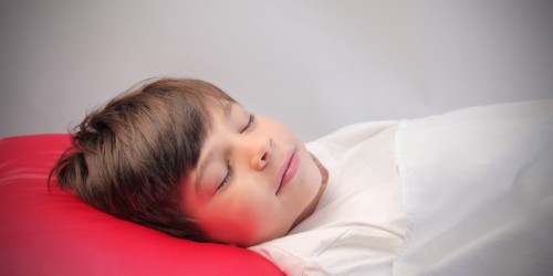 Does Your Child Grind Their Teeth At Night? 7 Things You Should Know About Bruxism