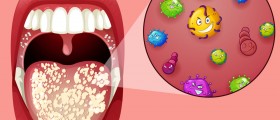 5 Common Infections In Diabetes Patients And How To Prevent Them