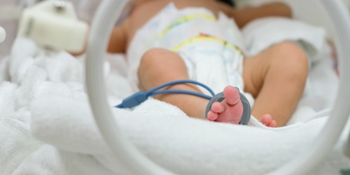Congenital Heart Disease: Symptoms, Diagnosis And Treatment Options For Patent Ductus Arteriosus