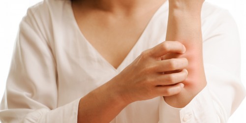 Diabetes And Skin Problems: 12 Diabetic Conditions You Need To Know About